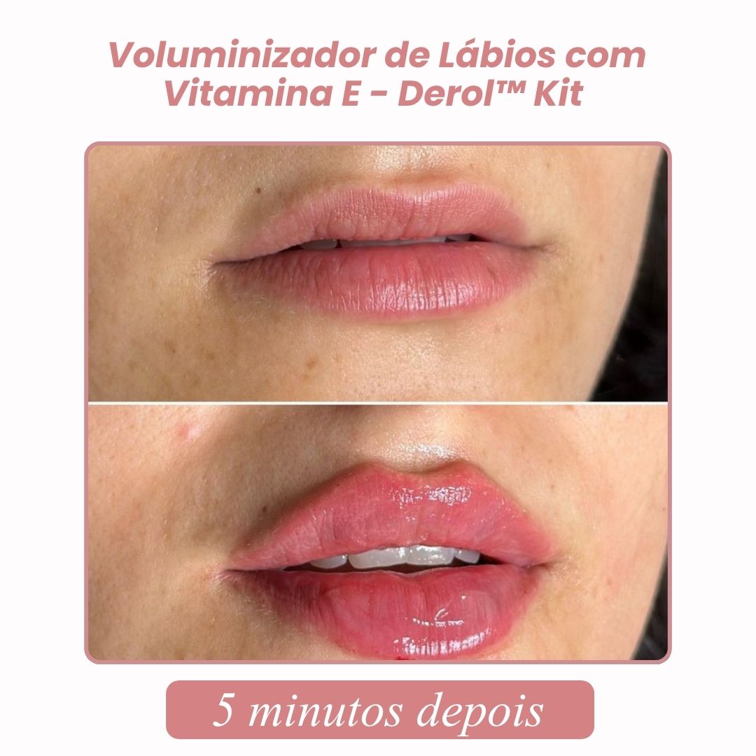 Voluminizador de Lábios com Vitamina E - Derol™ Kit | 1+1 GRÁTIS
