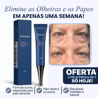 CREME PARA OLHEIRAS E PAPOS | 100% de eficácia | OpenEyes™ (2 + 1 GRÁTIS)