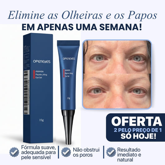 CREME PARA OLHEIRAS E PAPOS | 100% de eficácia | OpenEyes™ (2 + 1 GRÁTIS)