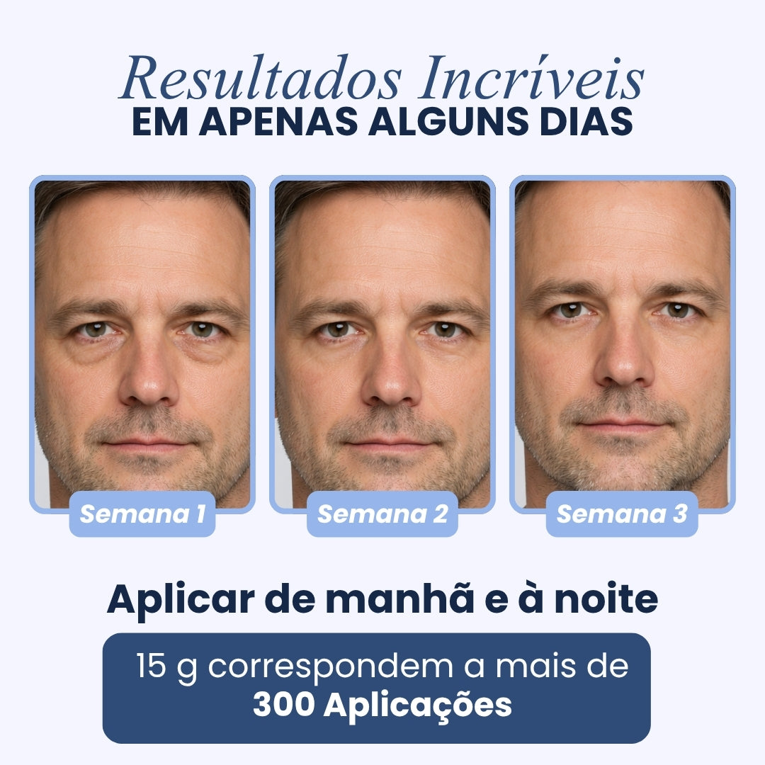 CREME PARA OLHEIRAS E PAPOS | 100% de eficácia | OpenEyes™ (2 + 1 GRÁTIS)
