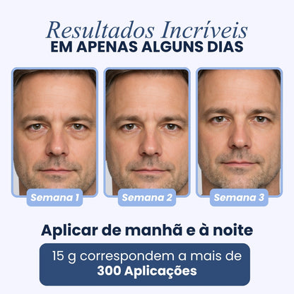 CREME PARA OLHEIRAS E PAPOS | 100% de eficácia | OpenEyes™ (2 + 1 GRÁTIS)