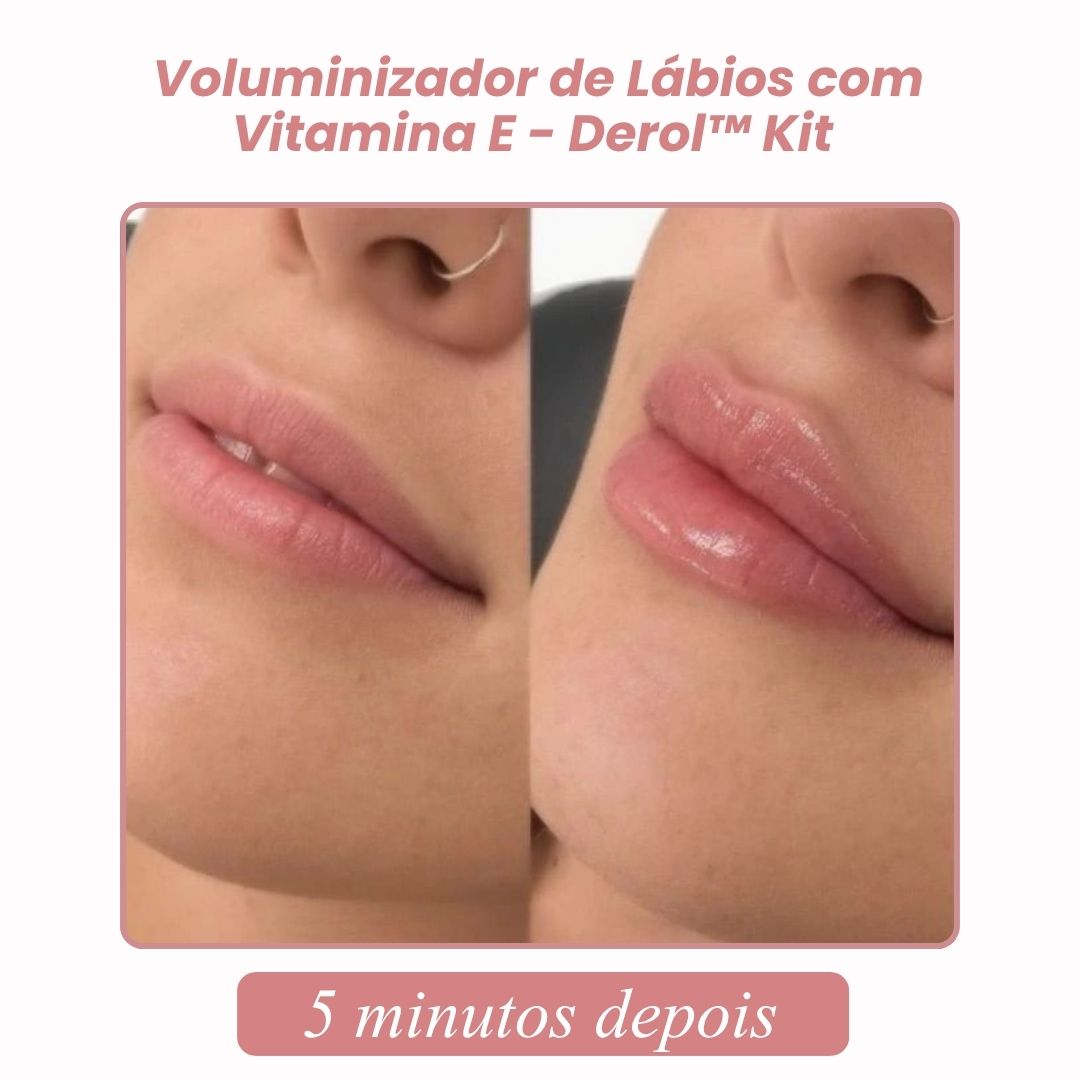 Voluminizador de Lábios com Vitamina E - Derol™ Kit | 1+1 GRÁTIS